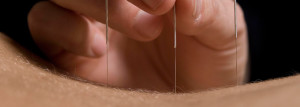 acupuntura girona