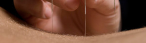 emilio los huertos acupuntor